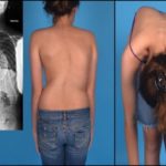 Болит грудина посередине и отдает в спину