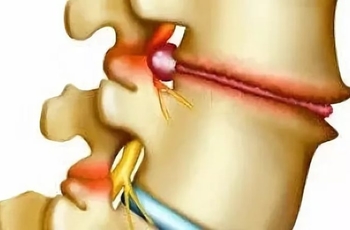 При наклоне головы болит в районе лопатки