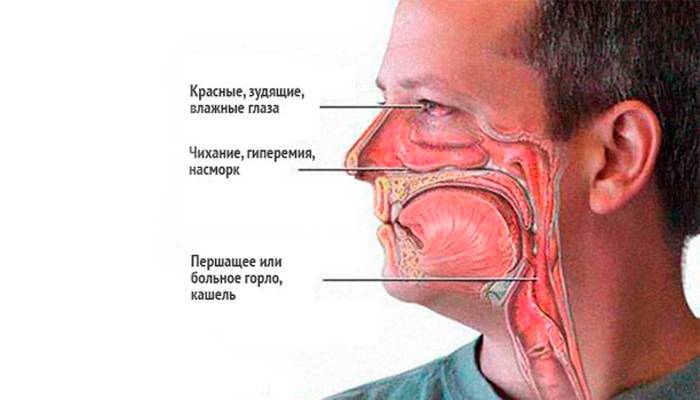 Возможный ангиноневрический отек в следствии смешивания Терафлю и алкоголя
