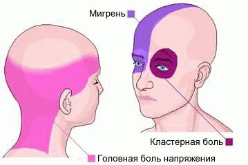 Что делать когда болит голова таблетки не помогают