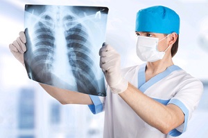 Рентгеновский снимок легких