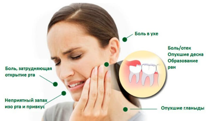 Неудобства причинённые зубной болью 